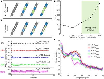 Unraveling the complexities of programming neural adaptive deep brain stimulation in Parkinson’s disease
